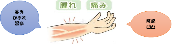 シャントトラ.png